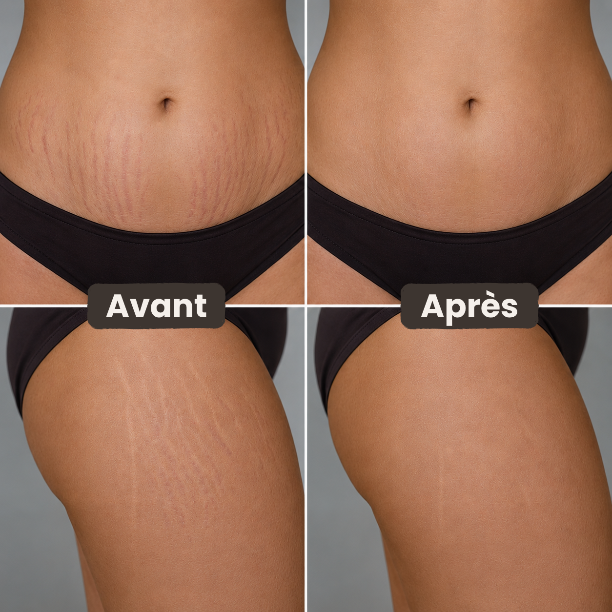 Le Stick — Silicone Médical Anti-Cicatrices