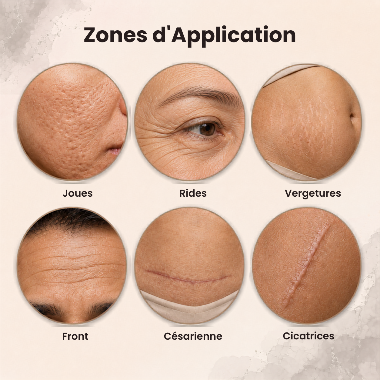 Le Stick — Silicone Médical Anti-Cicatrices
